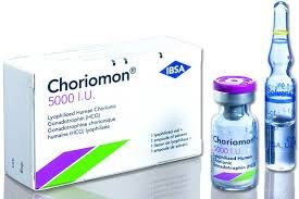HCG Choriomon 5000IU